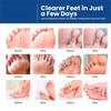 Athlete's Foot Care Cream Remove Feet Odor Itch Ointment Beriberi Foot Peeling Plaster30g