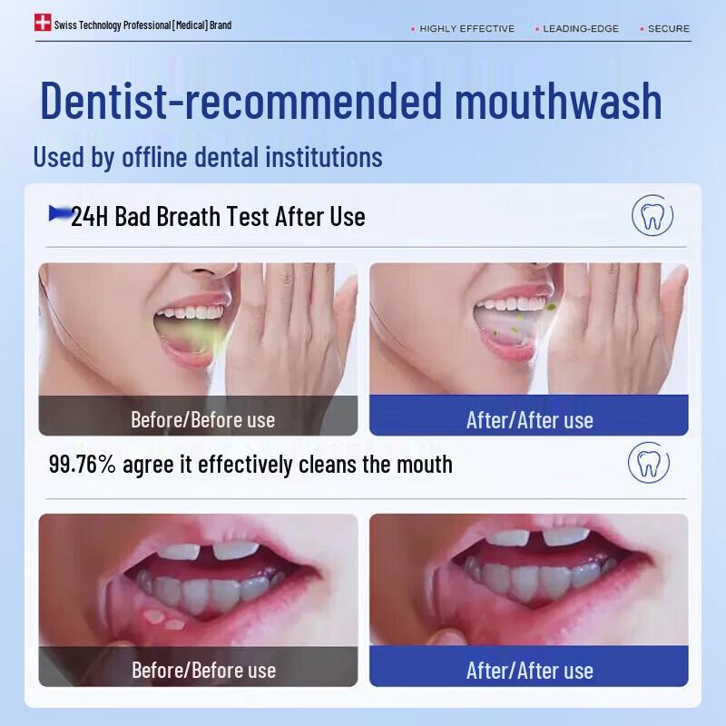 BEAUTY NOTES Oral Care Mouthwash & Rinse