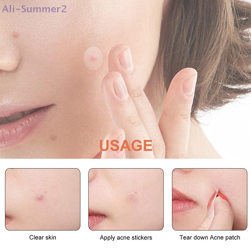 {Summer2} {Summer2} 36/180Pcs Invisible Hydrocolloid Acne Patches Round Transparent Pimple Sticker for Face Skincare Makeup Tool