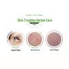 Qi Cao Li Qing Herbal Itch Relief Cream