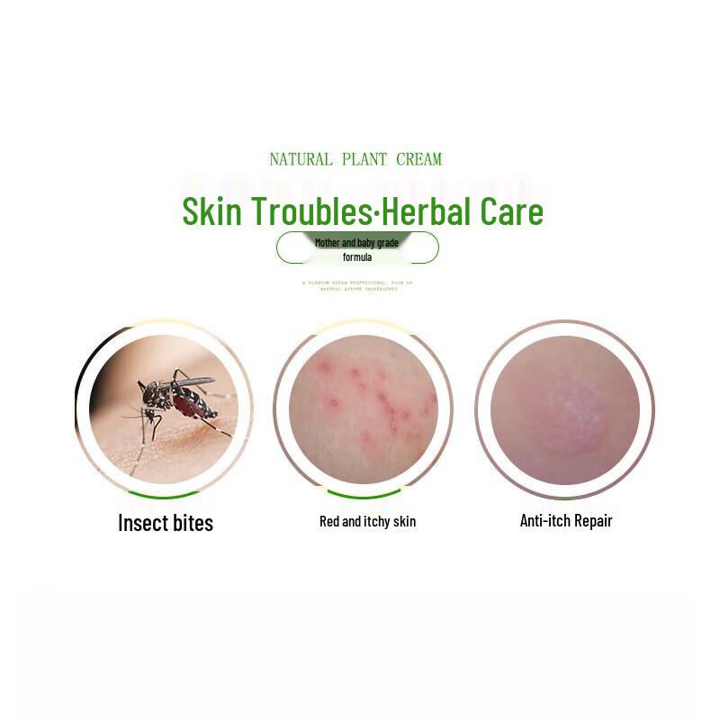 Qi Cao Li Qing Herbal Itch Relief Cream