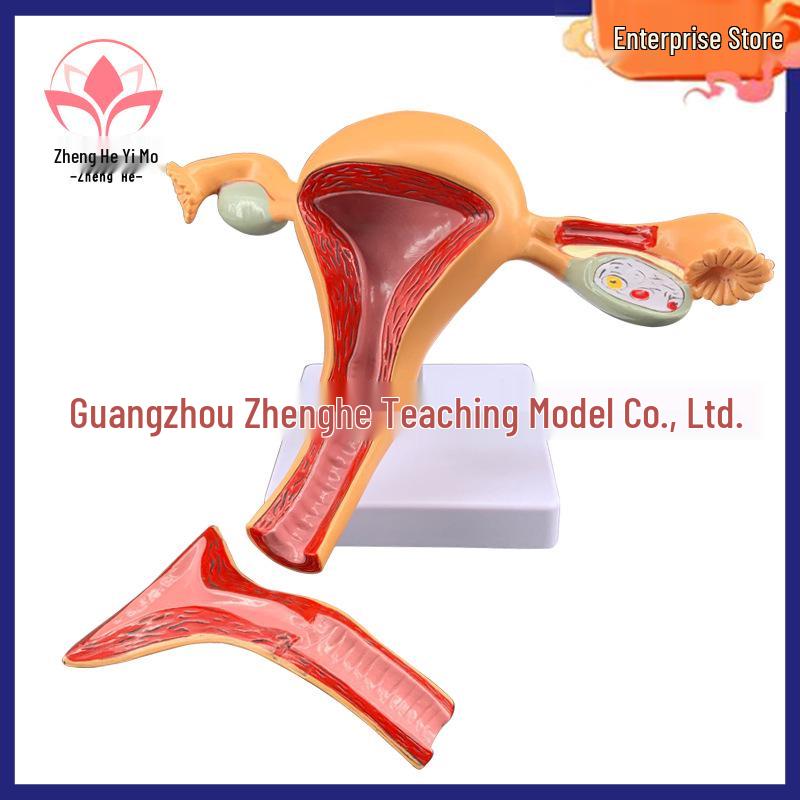 Female Reproductive System Model for Teaching and Gynecology 20x20x11 cm