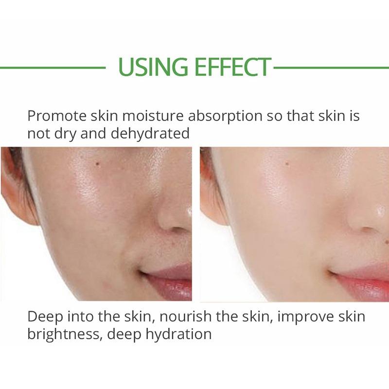 Tea Tree Moisturizing Serum Cream Anti-Acne Shrink Pores Face Cream Oil Control Hydrate Smooth Repair Skin Care