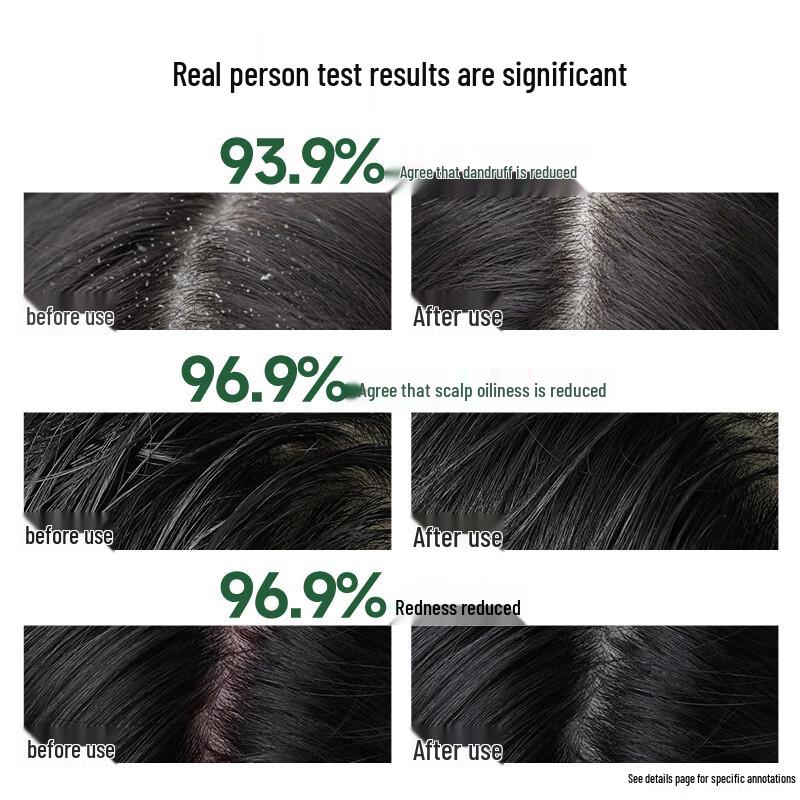 Hexin Scalp Care & Volumizing Essence