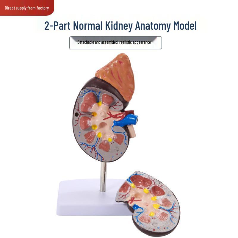 Magnified Human Kidney Model with Adrenal Gland and Diseased Anatomy
