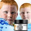 The Latest Horse Oil Freckle Cream, Fade, Stain, Sunburn, Chloasma, Freckles, Facial Care