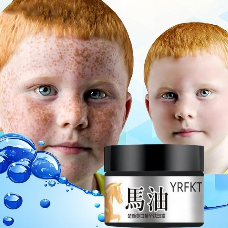 The Latest Horse Oil Freckle Cream, Fade, Stain, Sunburn, Chloasma, Freckles, Facial Care