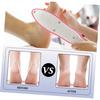 Foot File and Grinding Stone for Callus Removal Hard Skin Exfoliator Pedicure Rasp Tool