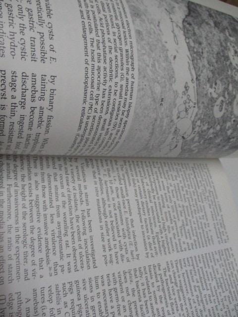 [USED] Hospital disposal book Gastroenterology 7 fourth English book