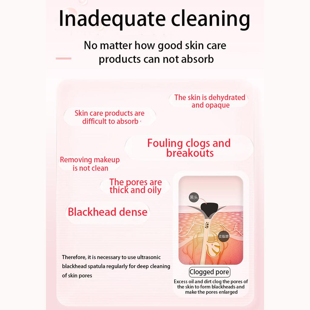 Ultrasonic Skin Scraper Electric Blackhead Shovel Beauty Scrubber Low Noise Sonic Vibration Pore