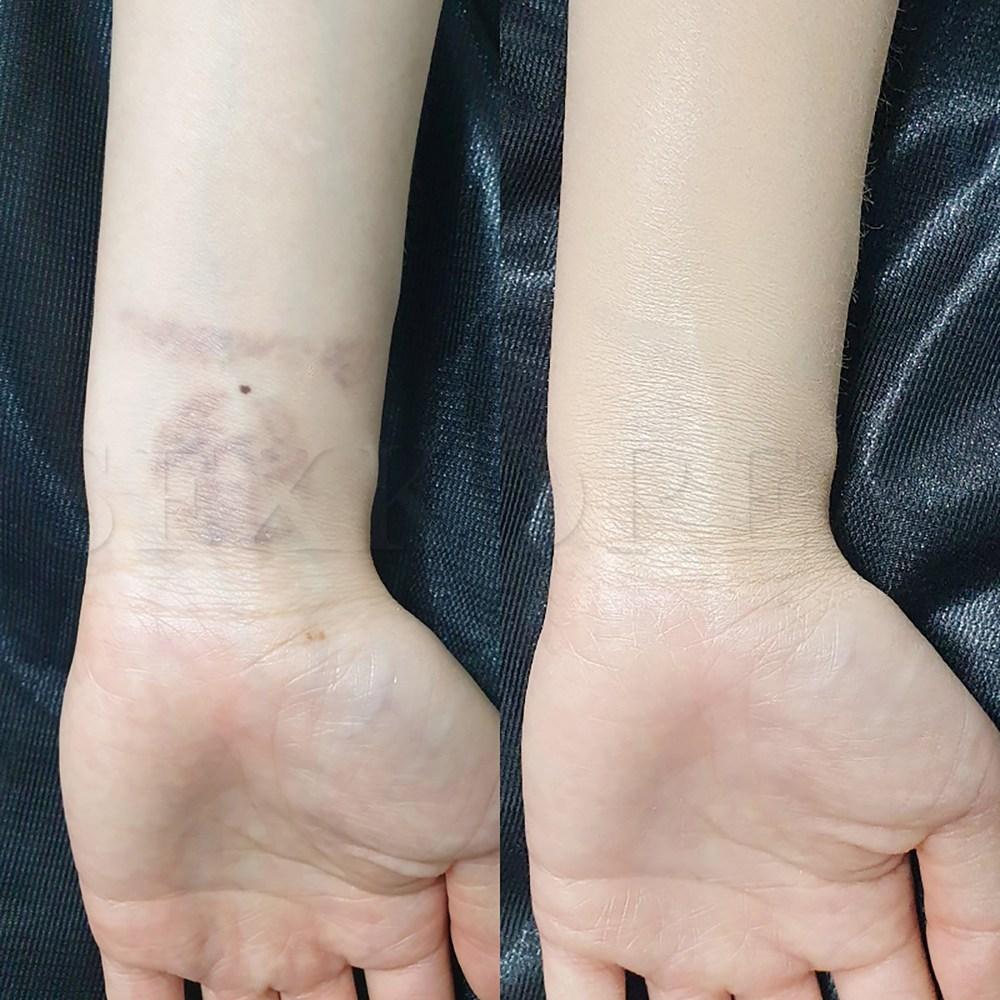 Tattoo cover, tattoo, vitiligo, scars, freckles, coffee spots, thin veins, blemishes concealer, SFX tattoo cover 1 set