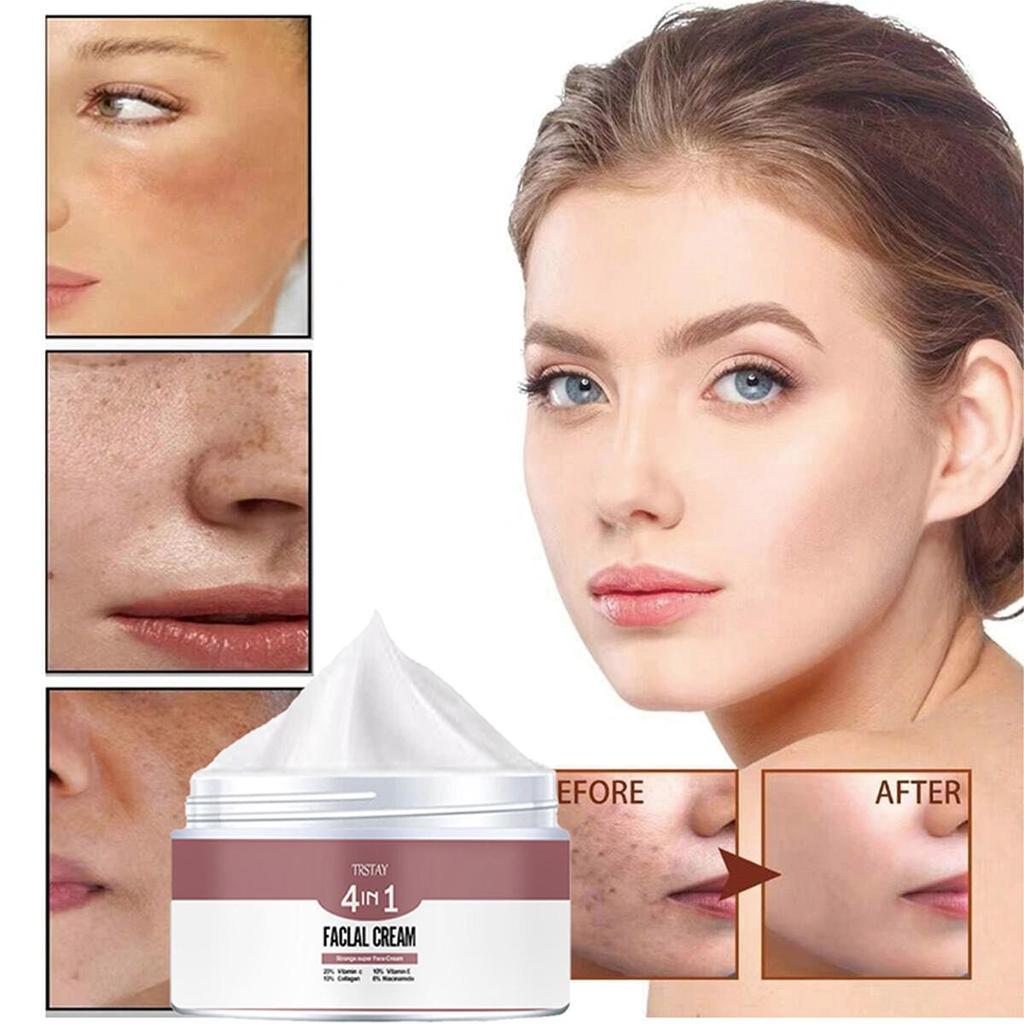 Moisturizing Face Cream Improves Dryness and Water Shortage. Adequate, Delicate, Moisturizing, Activating, and Caring for the Skin
