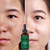 Pore Shrinking Serum Essence Pores Treatment Moisturizing Relieve Dryness Oil-Control Firming Repairing Smooth Skin Care