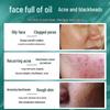 Tong Ren Tang Amino Acid Deep Cleansing Facial Cleanser