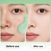 Blackhead Whitehead Removal Tool Skin Pore Cleaner Nose and Face Skin Care Tools for Women  Black Head Remover Skin Care Beauty