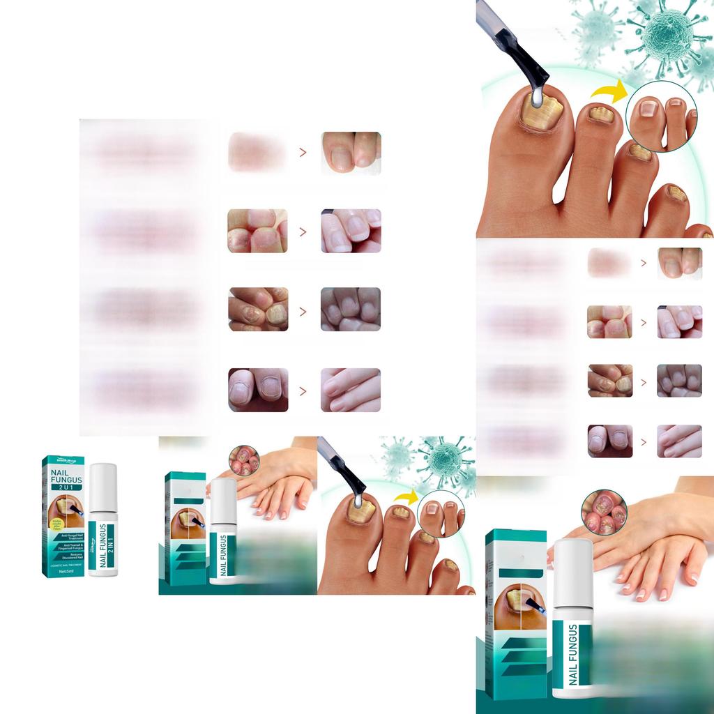 Преміальний розчин для відновлення нігтів на ногах 5 мл Для знебарвлених нігтів і пом'якшення нігтів