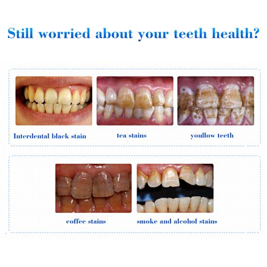 10ml Tooth Serum Effective Removing Stain Natural Extract Teeth Whitening Powder Clean Oral Essence