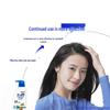 Head & Shoulders Anti-Dandruff Gentle Care Shampoo