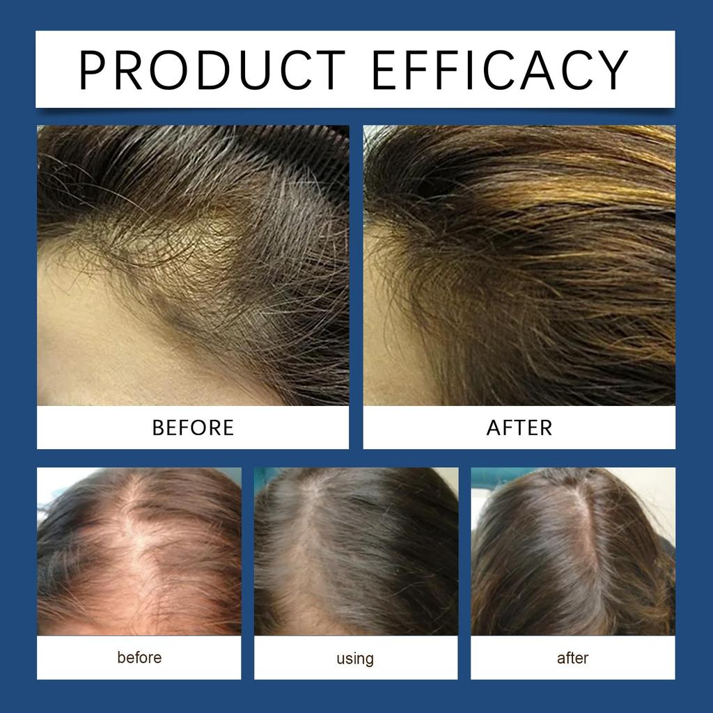 Blueberry Soothing Oil, All-in-one Oil, Nourishes Face, Body, Hair, Nails, For Diffusers And Aromatherapy,100ML