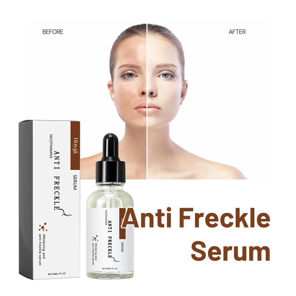 Hoygi Niacinamide Spot Brightening Serum Hydrating And Nourishing Skin Treatment For Dark Spots And Dull Complexion