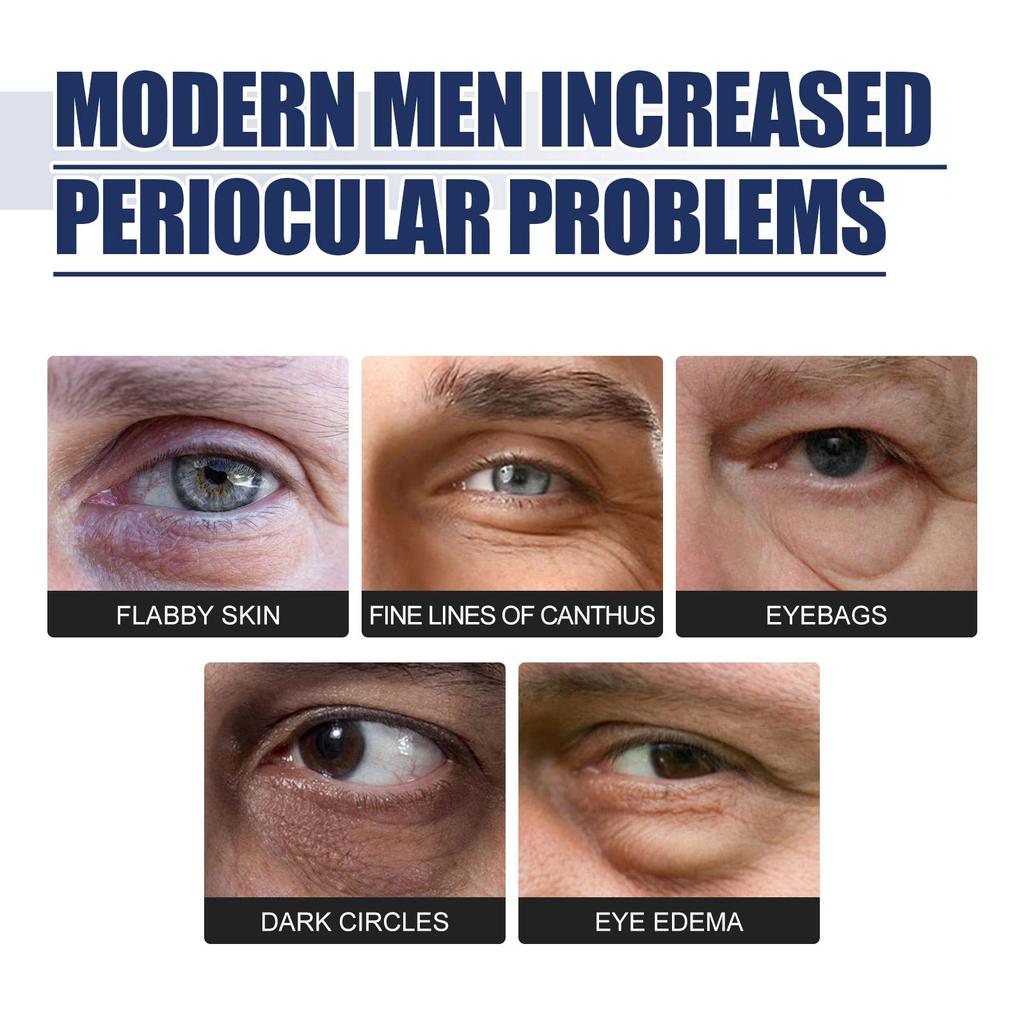 Anti-aging and Firming Eye Cream, Moisturizing and Hydrating, Repairing Dullness and Anti-aging Eye Care Cream