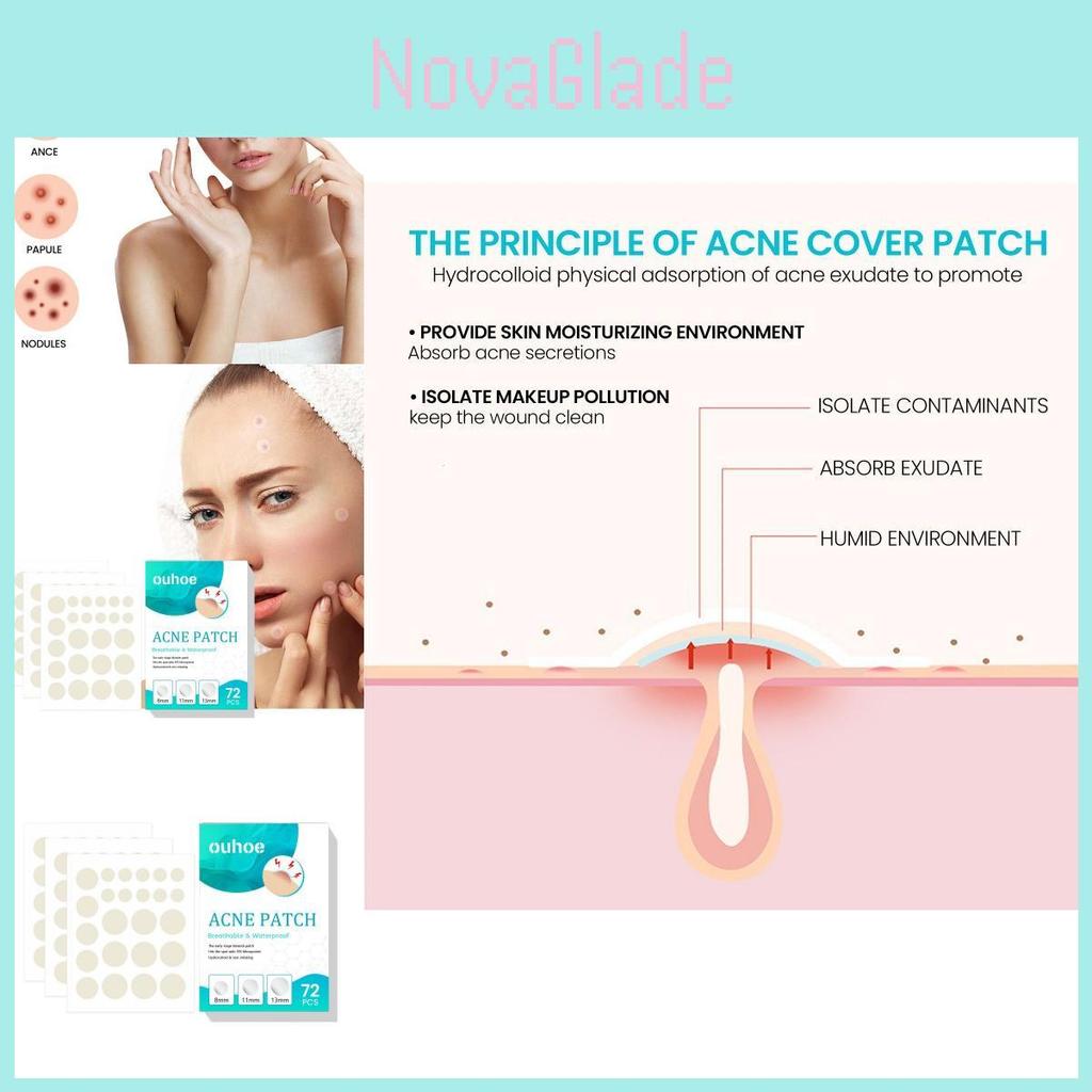 Ouhoe Acne Patches Gentle And Non-irritating Hydrocolloid Stickers For Flawless Skin 72pcs