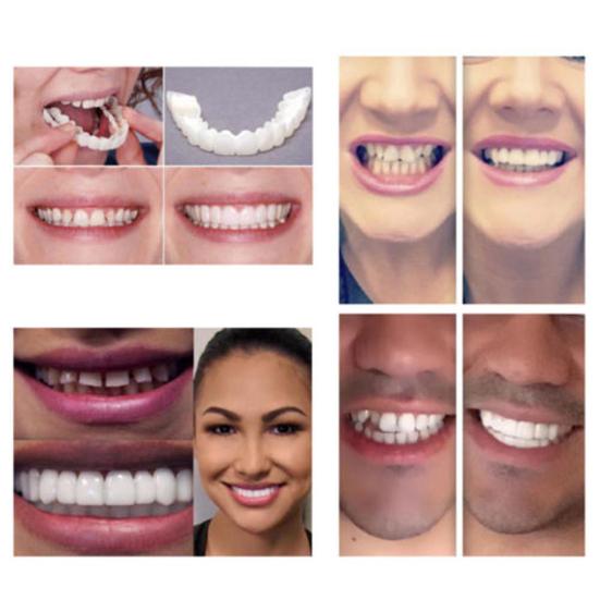 2Pcs Silicone Simulation Upper Bottom Teeth Denture Whitening Fake Tooth Cover