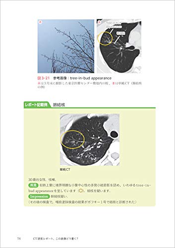 How to write a CT image reading report? - Basic knowledge of anatomy and findings, and examples of reports for common diseases
