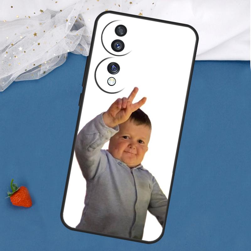 Funny Hasbulla Case For Honor Magic 7 5 6 Lite 8 Pro 200 400 50 70 90 X8c X8b X9a X9b X9c X9d Win RT Cover