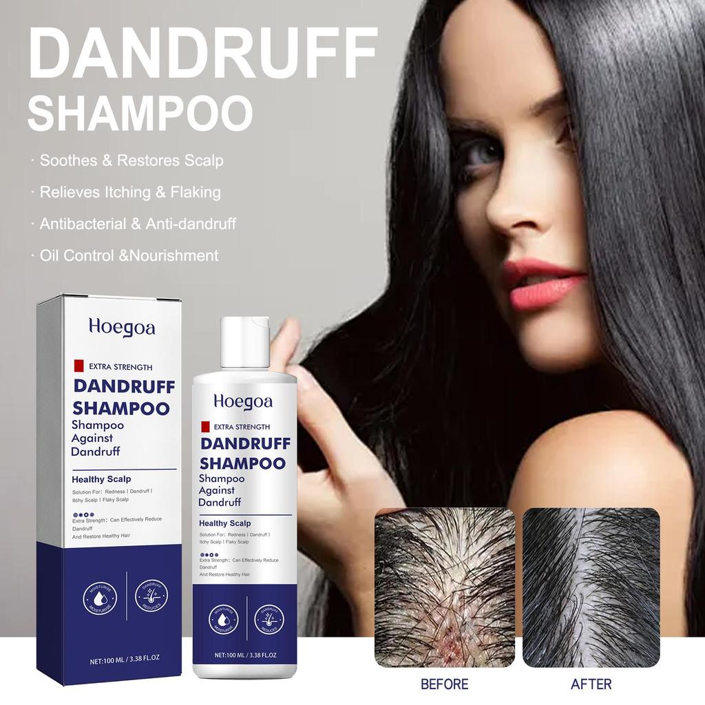 Hoegoa folliculitis shampoo, anti-hair loss, deep cleansing, strong hair, solid hair, dense hair care shampoo