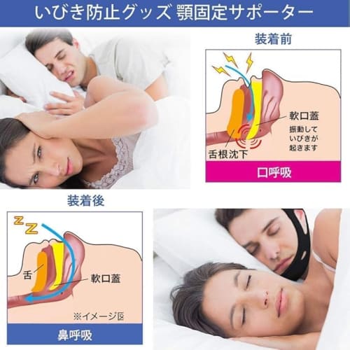 Anti-Snoring Device, Prevents Mouth Breathing, Supports Nasal Breathing, Prevents Sleep Apnea, Reduces Snoring, Prevents Sore Throat, Anti-Snoring Bel