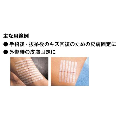 3M Nexcare SteriStrip Standard Skin Closure Skin Bonding Tape 12 Pieces SS12