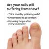 Foot Nail Pen Cracked Nail, Embedded Nail Care Solution, Soft Nail, Gray Pen 4ml