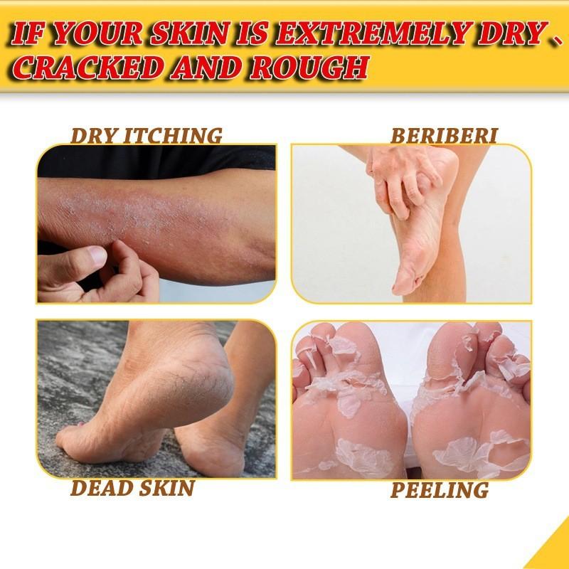 Jaysuing Moisturizing Foot Cream For Deep Hydration And Skin Repair For Cracked Dry Feet