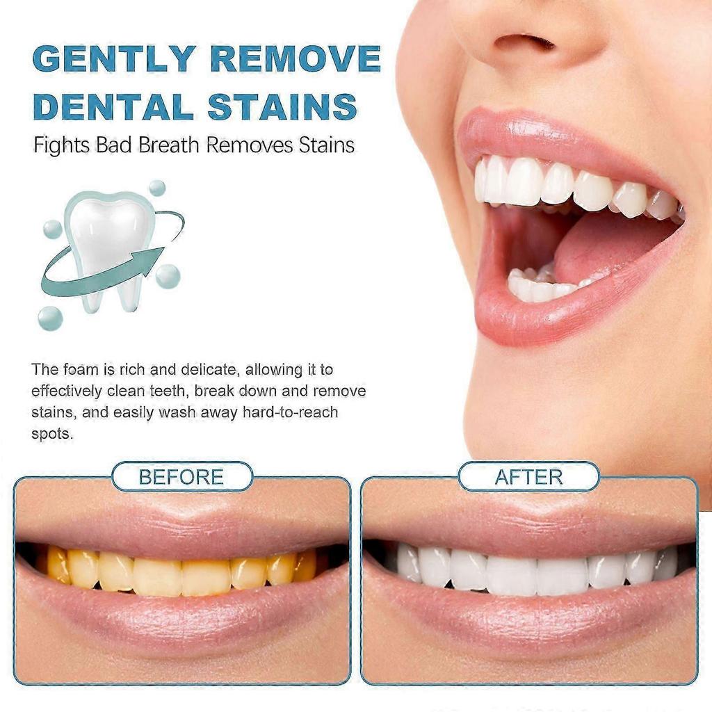 Beauty Tooth Fresh Mousse - Whitening Toothpaste for Bad Breath & Stain Removal, 60ml