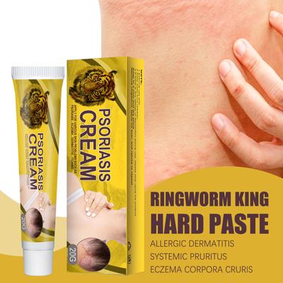Skin Repairs Cream, External Application Ointment For Flower Spots, Moss, Flower Spots, Skin Itching Cream