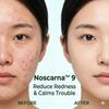 FATION Nosca9 Trouble Serum 30ml x2 Set / Acne Care / Korean Skincare