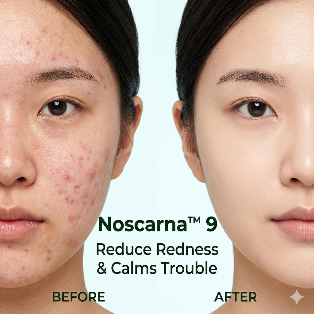 FATION Nosca9 Trouble Serum 30ml x2 Set / Acne Care / Korean Skincare