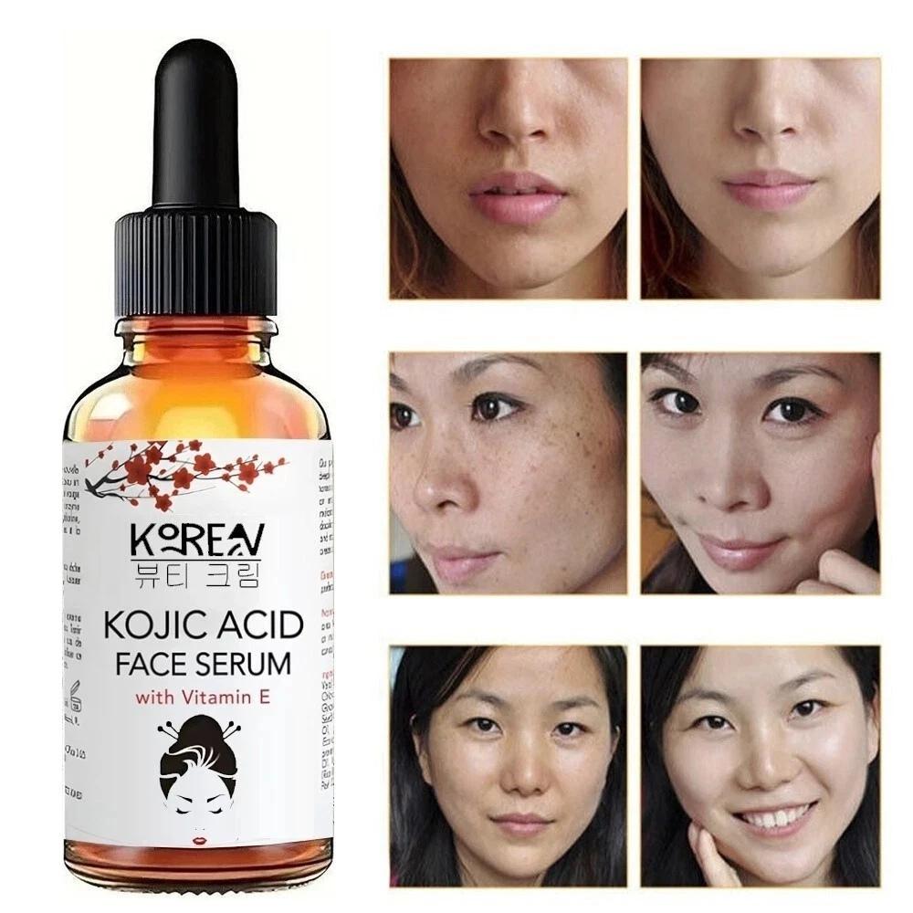3Pcs Kojic Acid Serum - Collagen Face Serum for Skin Lig_htening - Anti Aging Face Serum - Dark Spot Correcting Glow Serum 30ml
