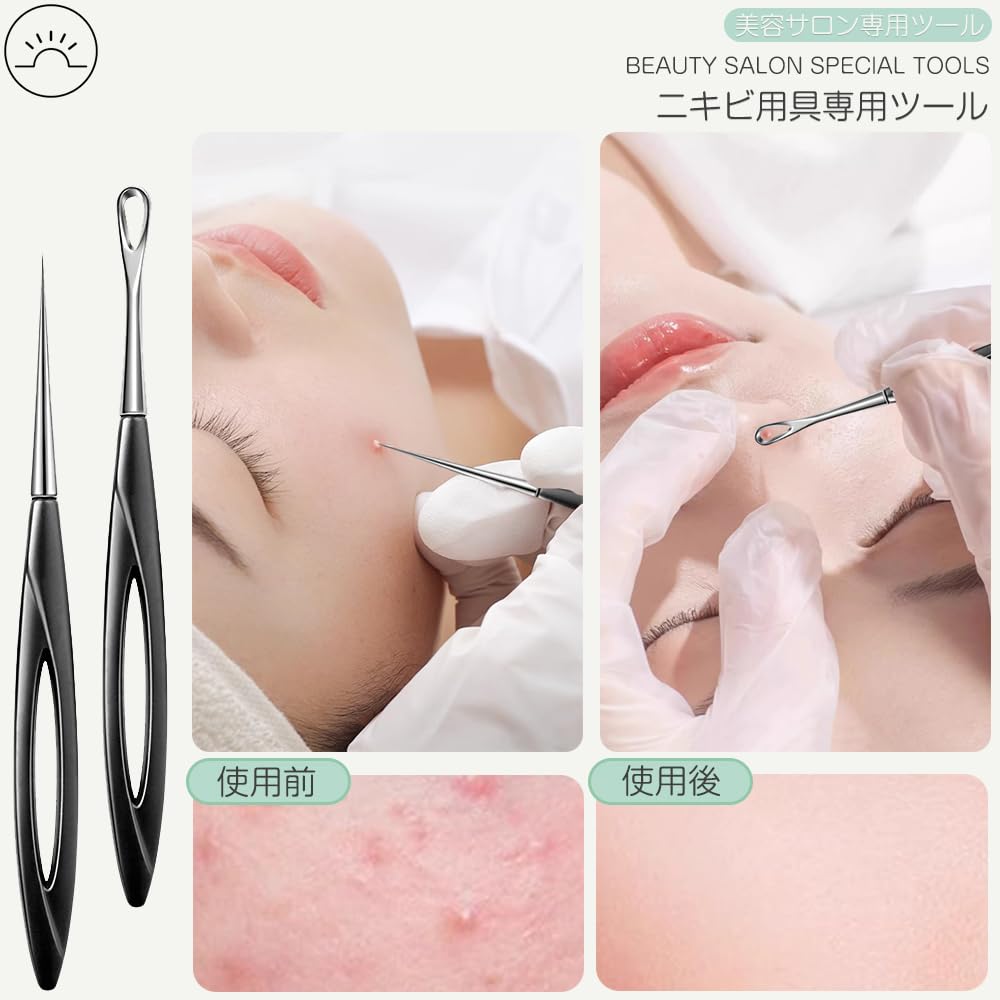 Acne Needle Blackhead Removal Blackhead Comedo Acne Removal Pore Care Acne Beauty Tool Cell Needle 1 Cell Kit, 2-Piece Set, Tool, Pusher, Extractor,