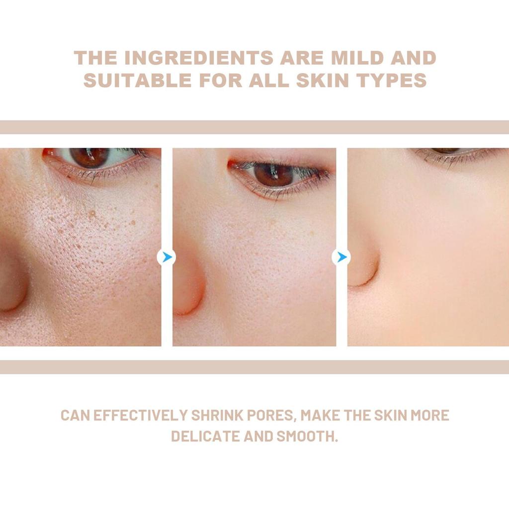 Exfoliating Gel Skin Gentle Cleansing Pore Shrinking Rejuvenating Exfoliating Blackhead & Acne Gel