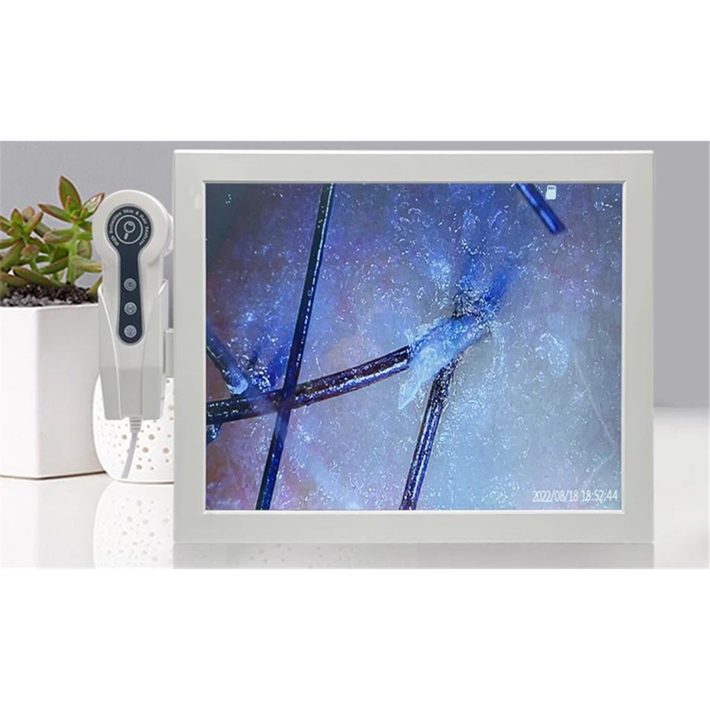 HD Digital Skin Analyzer Professional Hair Scalp Camera Detector Hair Follicle Oil Moisture Test Device 15inch