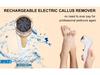 Electric Callus Remover Foot File: Rechargeable Pedicure Tool and Best Seller.