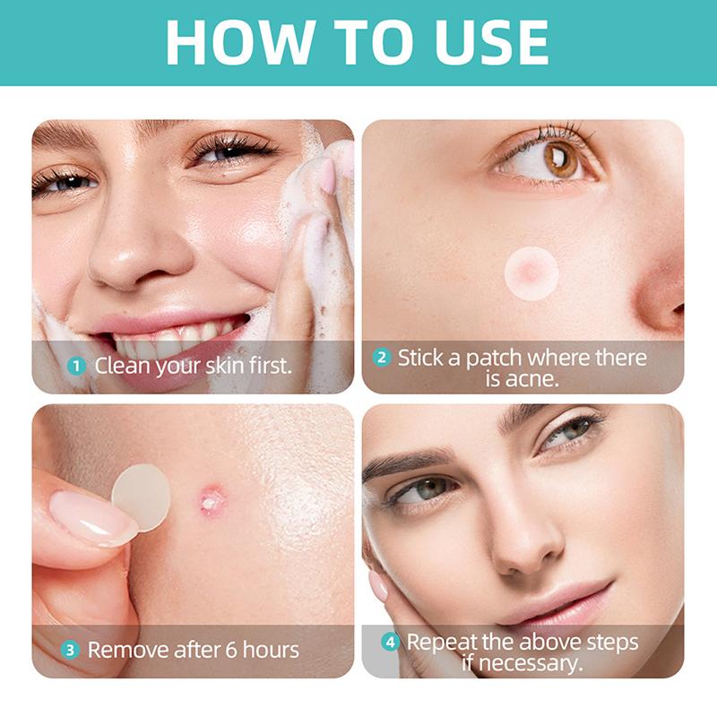 Acne Patch Facial Repair Acne Clean Pores Moisturize And Smooth Skin Acne Patch Facial Stickers Skin Care Tools