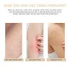 Body Moisturizing Cream 226g Skin Smoothing Butter for Keratosis Pilaris Treatment, Brightening Nourishing Body Care