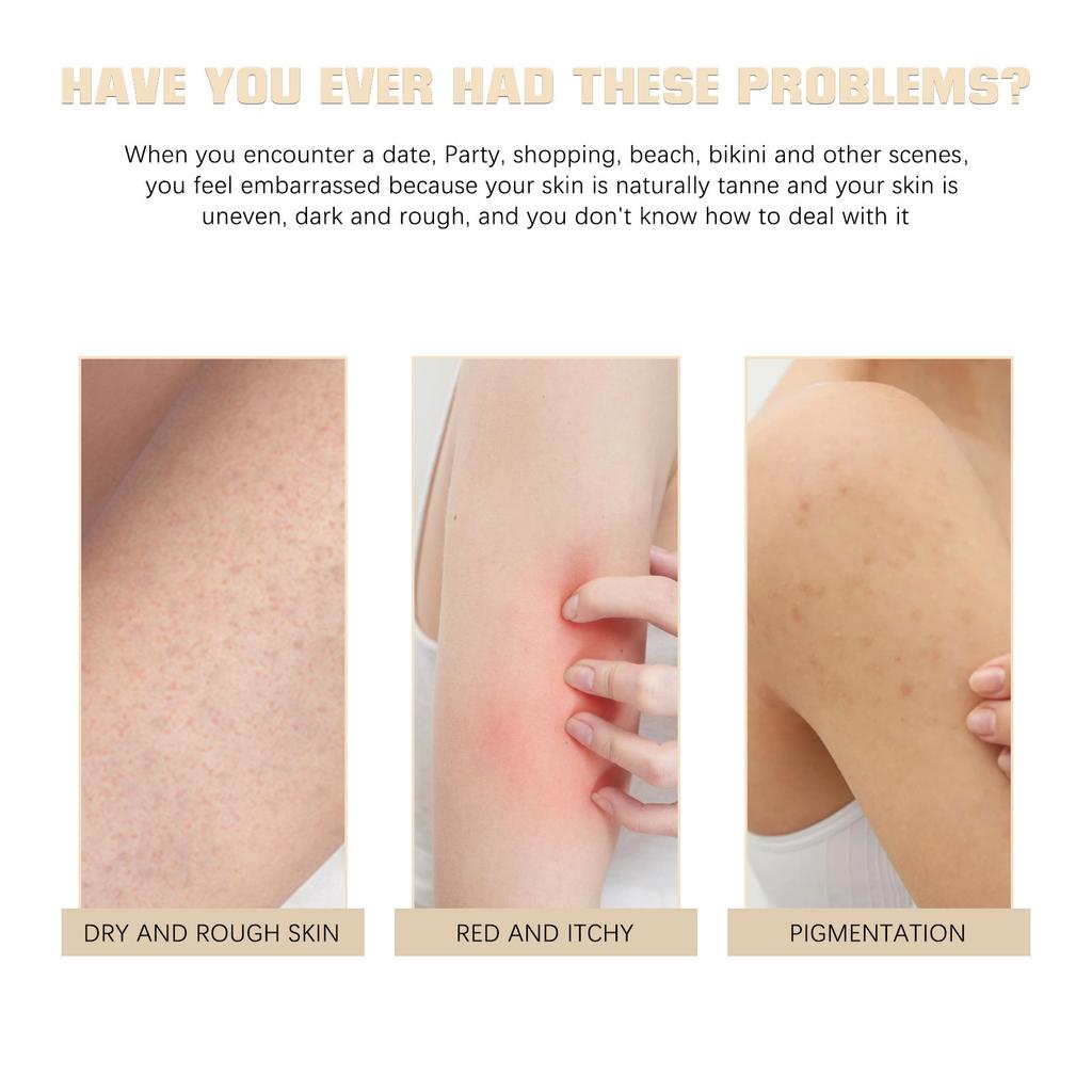 Body Moisturizing Cream 226g Skin Smoothing Butter for Keratosis Pilaris Treatment, Brightening Nourishing Body Care