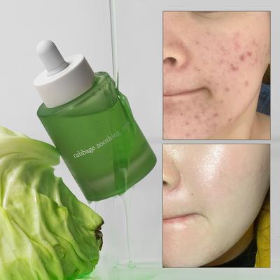Elimer Cabbage Soothing Repair Serum Essence, 1 Stück, 50 ml