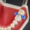 20 szt./60 szt./120 szt. Matryce stomatologiczne profilowane sekcyjne Matryce Matrix Bands Tofflemire Stuck materiał do laboratorium dentystycznego S/M/L