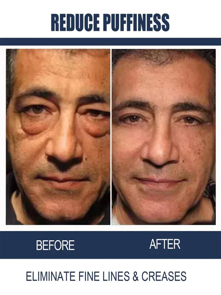 Eye Firming Cream Brightens the Eyes, Improves Dullness, Evenly Distributes Skin Tone, Moisturizes and Moisturizes the Eye Cream