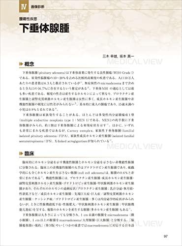 Pituitary gland imaging